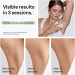 Braun IPL Silk·expert Mini PL1114 IPL-laite - Pilt 3