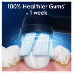 Oral-B iO Gentle Care vahetushari, must, 8 tk - Pilt 2